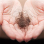 prevent-hair-loss-with-these-vitamins